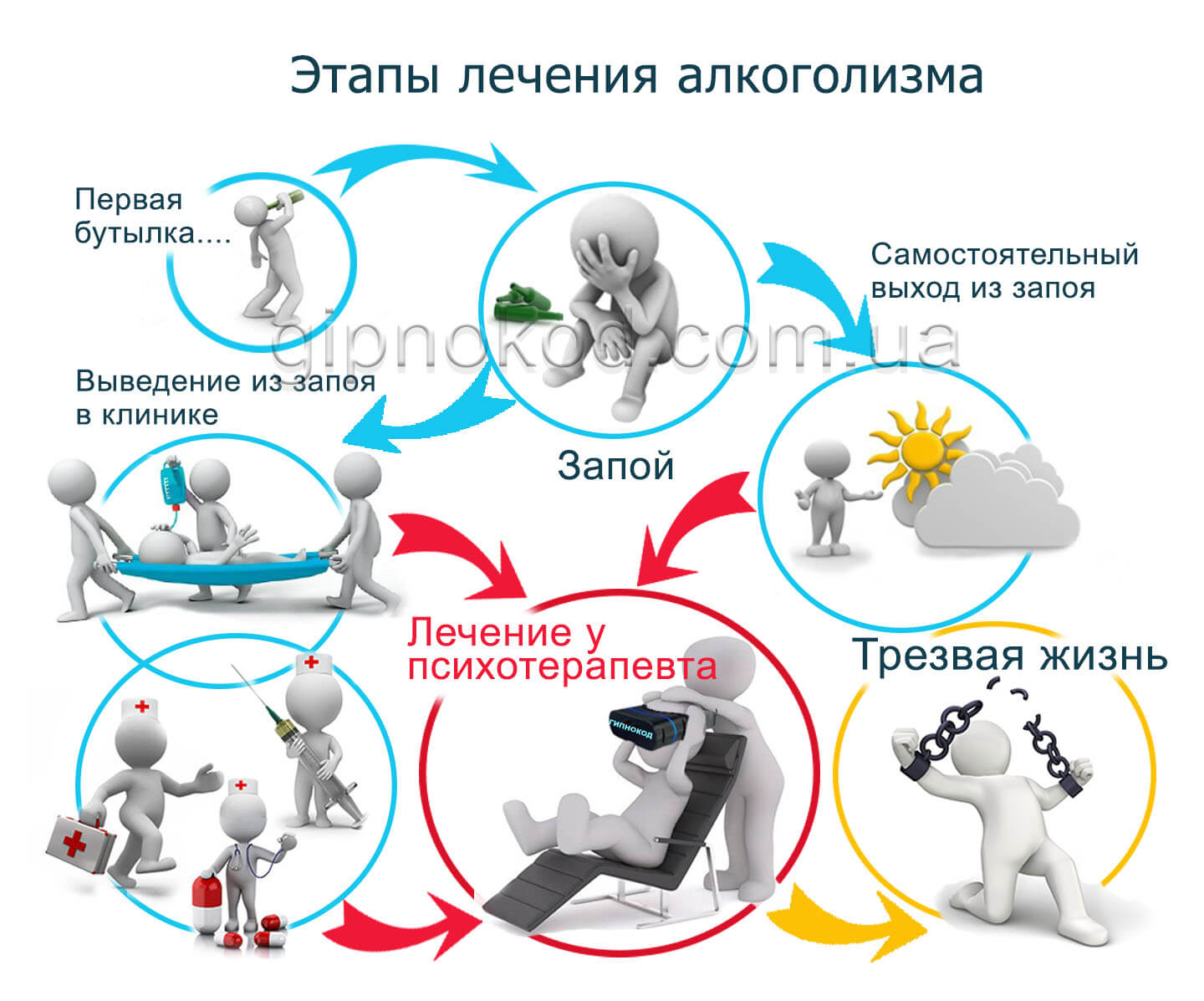 Схема лечения алкоголизма
